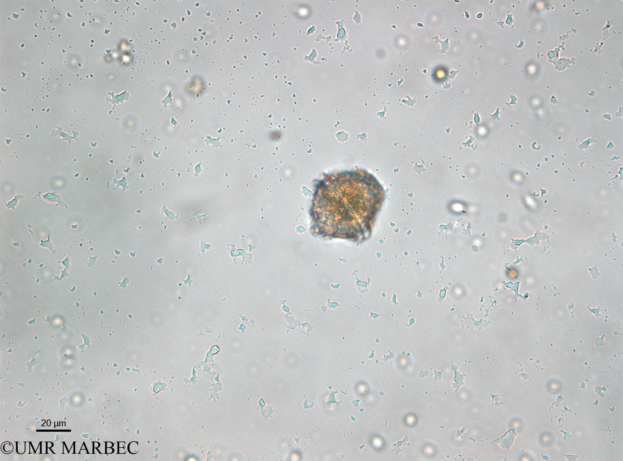 phyto/Bizerte/bizerte_lagoon/RISCO April 2014/Lingulodinium polyedrum (old Protoceratium reticulatum syn. Gonyaulax grindleyi - 140730_001_ovl-2)(copy).jpg